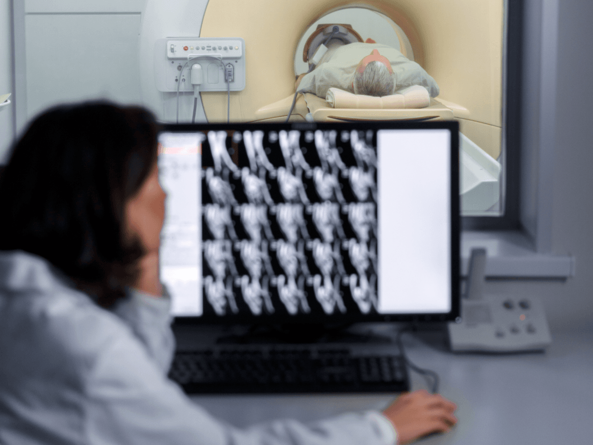 Deep Learning Models Predict Microvascular Invasion in HCC